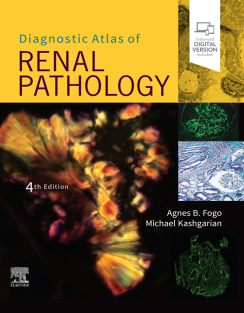 Diagnostic Atlas of Renal Pathology 4th Edition