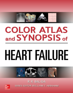 Color Atlas and Synopsis of Heart Failure 1st edition