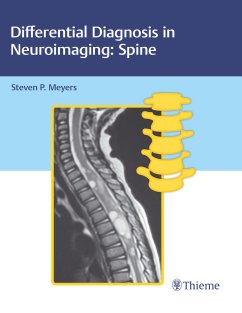 Differential Diagnosis in Neuroimaging Spine