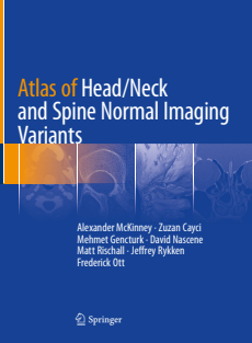 Atlas of Head Neck and Spine Normal Imaging Variants 2018 Edition