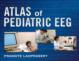 Atlas of Pediatric EEG