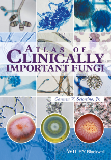 Atlas of Clinically Important Fungi 1st Edition