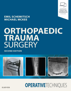 Operative Techniques Orthopaedic Trauma Surgery 2nd Edition