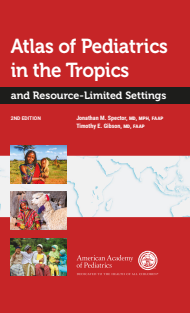 Atlas of Pediatrics in the Tropics and Resource-Limited Sett