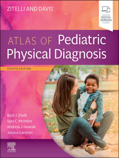 Zitelli_and_Davis'_Atlas_of_Pediatric_Physical_Diagnosis_8th_edition