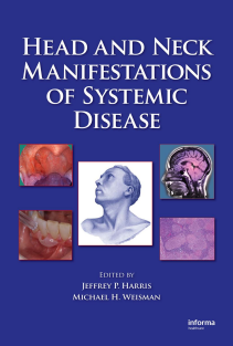 Head and Neck Manifestations of Systemic Disease 1st Edition