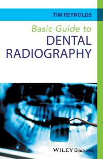 Basic guide to dental radiography