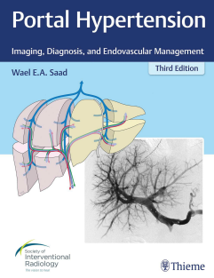 Portal Hypertension Imaging, Diagnosis, and Endovascular Management