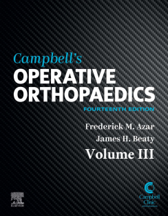 Campbell's Operative Orthopaedics, Volume III