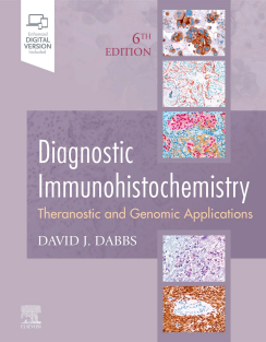 Diagnostic_Immunohistochemistry_Theranostic_and_Genomic_Applications