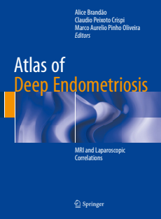 Atlas of Deep Endometriosis (Alice Brandão, Claudio Peixoto Crispi etc.)