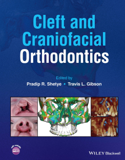 Cleft and Craniofacial Orthodontics 1st Edition 2023