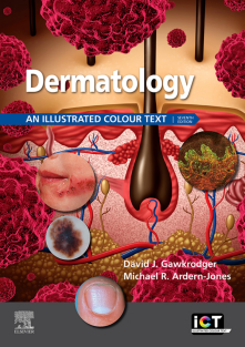 Dermatology An Illustrated Colour Text 7th Edition