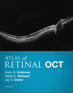 Atlas of Retinal oct Optical Coherence Tomography EXCLUSIVE