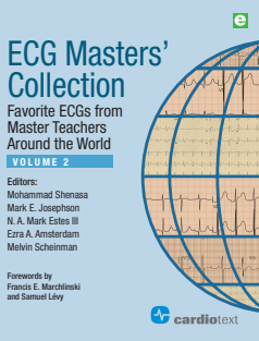 ECG Masters Collection. Favorite ECGs From Master Teachers Around The World VOL 2