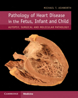 Pathology_of_Heart_Disease_in_the_Fetus,_Infant_and_Child_Autopsy