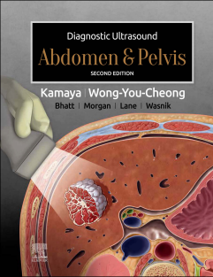 Diagnostic Ultrasound Abdomen and Pelvis 2nd Edition