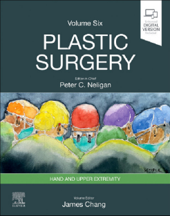 Plastic Surgery  Volume 6 Hand and Upper Limb 2023