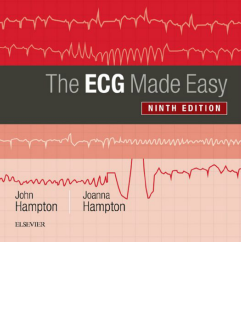 the ECG Made Easy