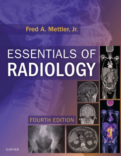 Essentials of Radiology