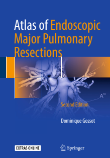 Atlas of Endoscopic Major Pulmonary Resections 2nd Edition