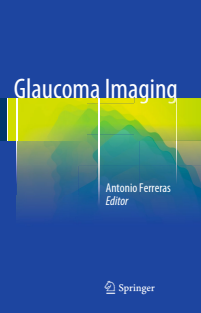 Glaucoma Imaging