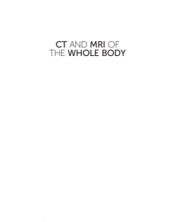 ct and mri of the whole body hagga