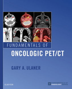 Fundamentals of Oncologic PET CT 