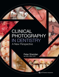 Clinical Photography in Dentistry A New Perspective