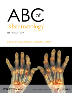 ABC of Rheumatology