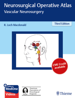 Neurosurgical Operative Atlas  Vascular Neurosurgery