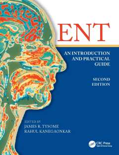 ENT An Introduction and Practical Guide, Second Edition By James Tysome Rahul 1138198234 CRC Press 2017-12-06