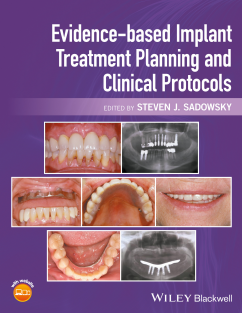 Evidence based Implant Treatment planning and clinical protocols