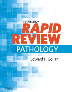 Rapid Review Pathology E-Book By Edward F. Goljan 0323476686 Elsevier 2018-02-27.PDF