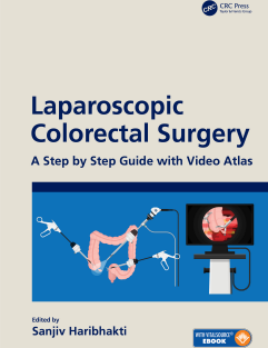 Laparoscopic Colorectal Surgery A Step by Step Guide with Video Atlas 1st Edition