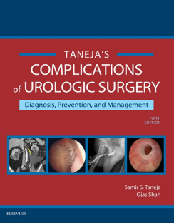 ---Complications of Urologic Surgery E-Book Prevention and Management .PDF