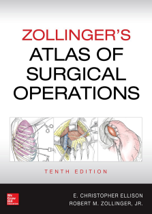 RRR-Zollinger's Atlas of Surgical Operations 10-CD-2016-12121(www.ketabpezeshki.com)