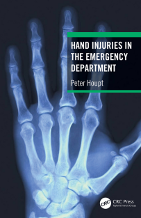 Hand Injuries in the Emergency Department 1st Edition