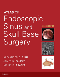 Atlas of Endoscopic Sinus and Skull Base Surgery