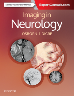 Imaging in NeUrology 