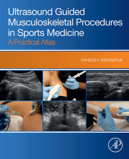 Ultrasound Guided Musculoskeletal Procedures in Sports Medicine A Practical Atlas 1st Edition