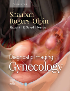 Diagnostic Imaging Gynecology 3rd edition 2021