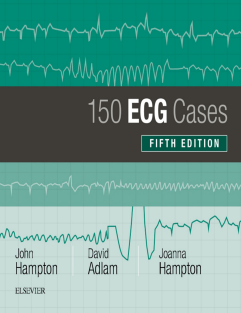 150 ECG Cases 5th Edition 2019