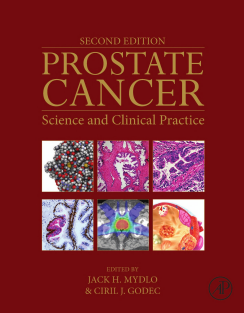 Prostate Cancer, Second Edition Science and Clinical Practice 2nd Edition