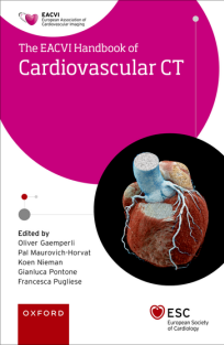 EACVI_Handbook_of_Cardiovascular_CT_The_European_Society_of_Cardiology