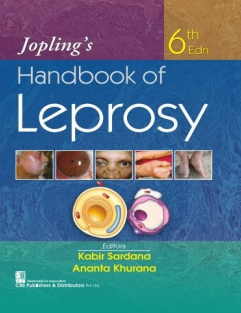 Joplings Handbook of Leprosy (Kabir Sardana, Ananta Khurana)