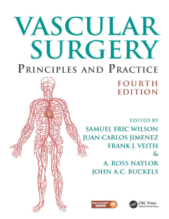 Vascular Surgery Principles and Practice 