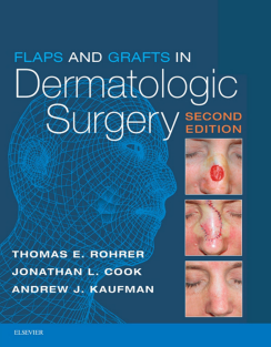 Flaps and Grafts in Dermatologic Surgery