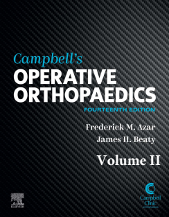 Campbell's Operative Orthopaedics, Volume II