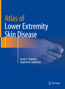 Atlas of Lower Extremity Skin Disease 2023